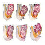 足月胎兒分娩過程模型